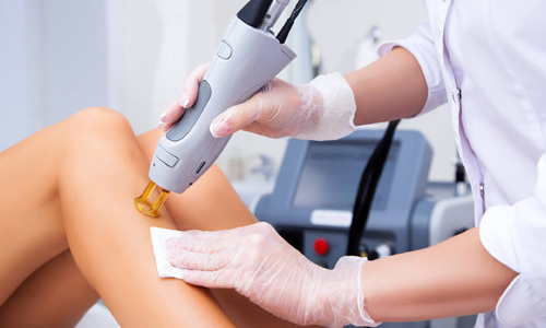 Laser Hair Removal